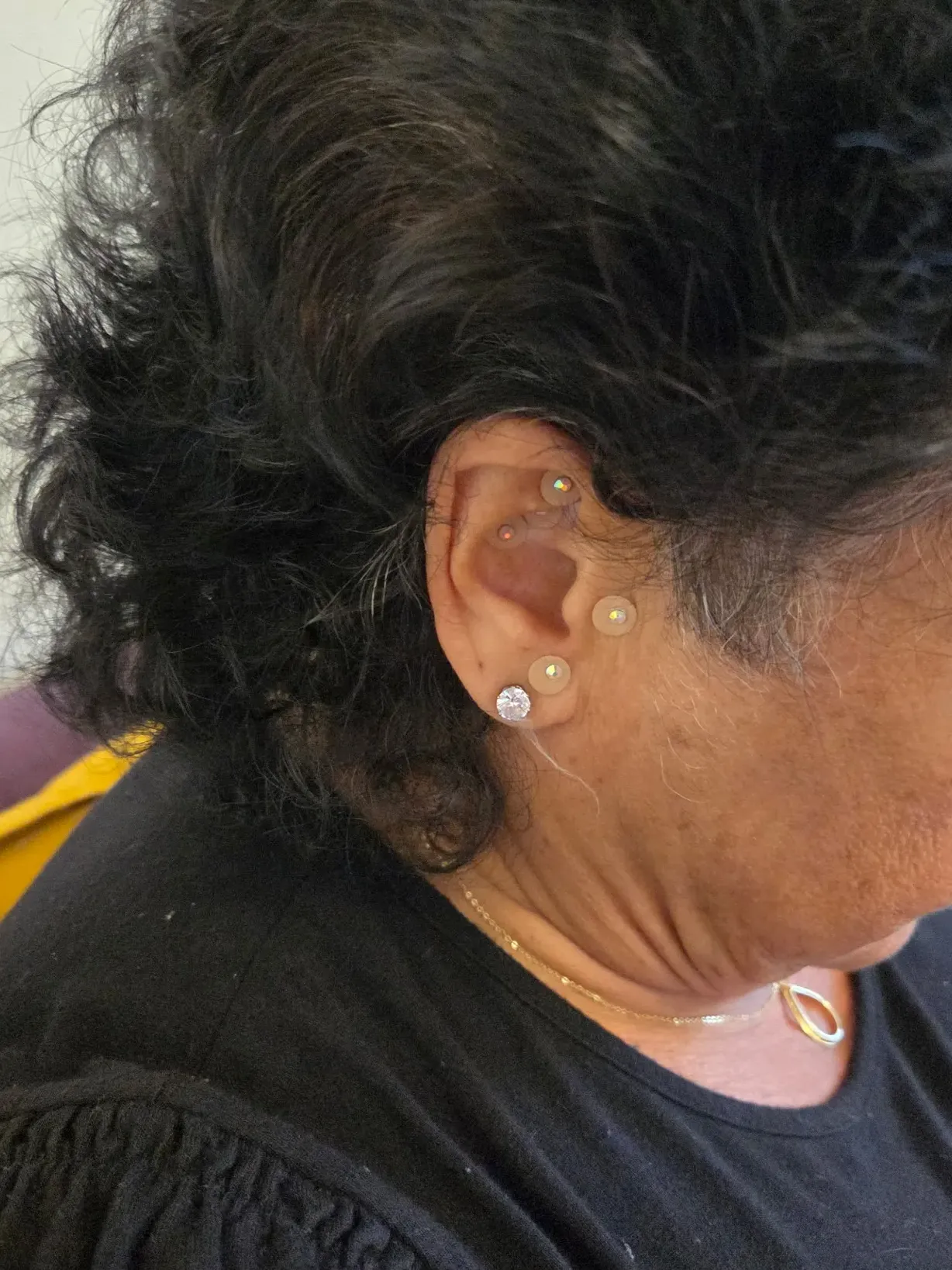 Auriculotherapy session using ear seeds for balance and relaxation at Eliza Balance Wellness & Beauty